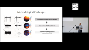 Rhythm and perception during development M Hubert Preissl