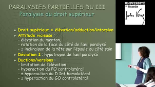 Orthoptie : les déviations verticales
